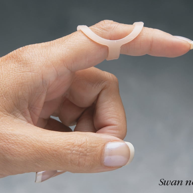 Oval-8 Finger Splint
